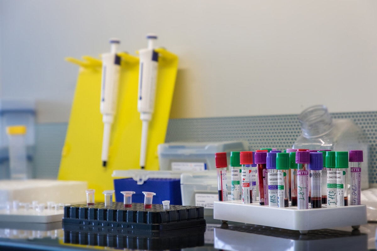 nejroset dlya diagnostiki skorosti stareniya usovershenstvovali uchyonye nngu